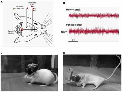 Oscillatory Cortical Activity in an Animal Model of Dystonia Caused by Cerebellar Dysfunction